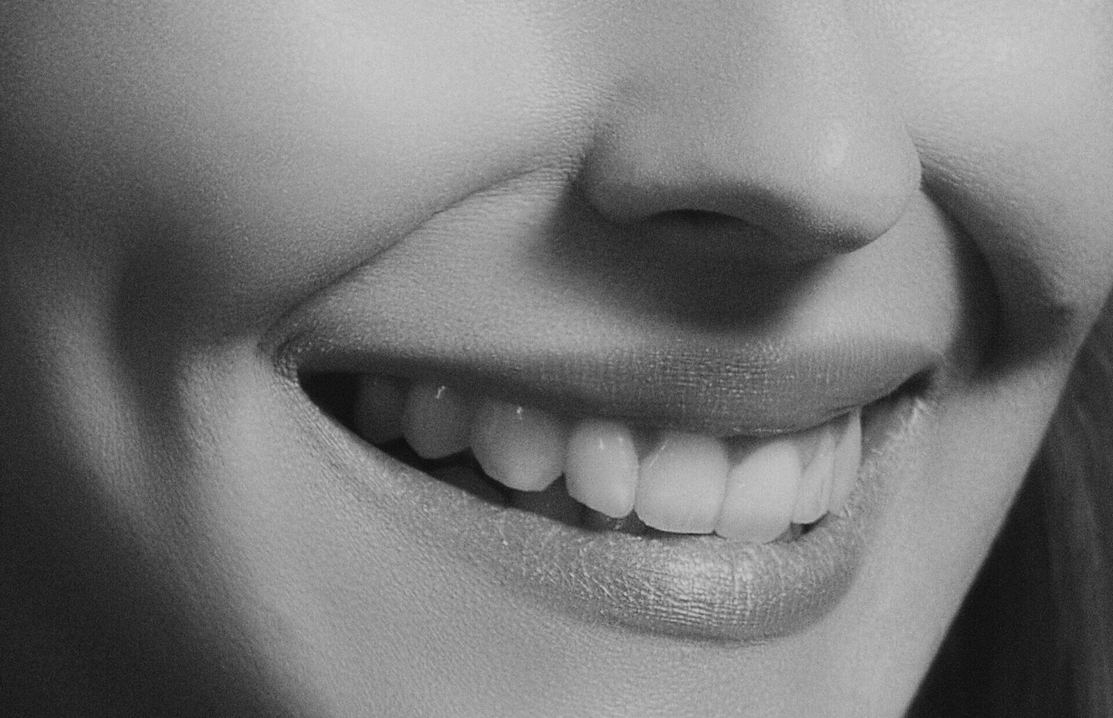 Responsible cosmetic dentistry at ELEV8 Biological Dentistry, Beverly Hills